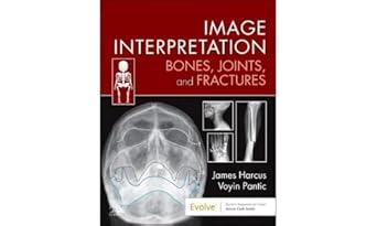 Image Interpretation: Bones, Joints, and Fractures - 1E