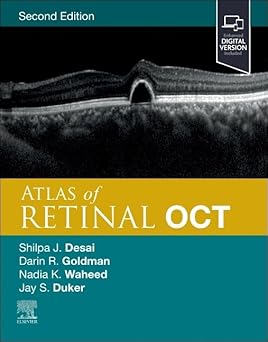 Atlas of Retinal OCT: Optical Coherence Tomography - 2E