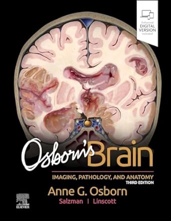 Osborn's Brain - 3E