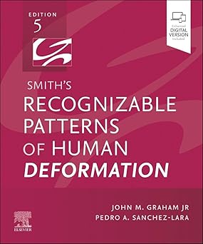 Smith's Recognizable Patterns of Human Deformation:  5E