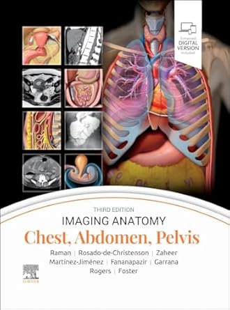 Imaging Anatomy: Chest, Abdomen, Pelvis-3E