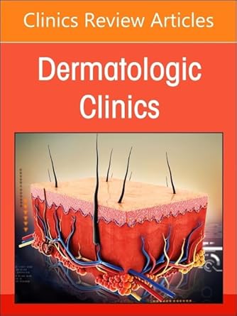 Psoriasis: Contemporary and Future Therapies, An Issue of Dermatologic Clinics-1E