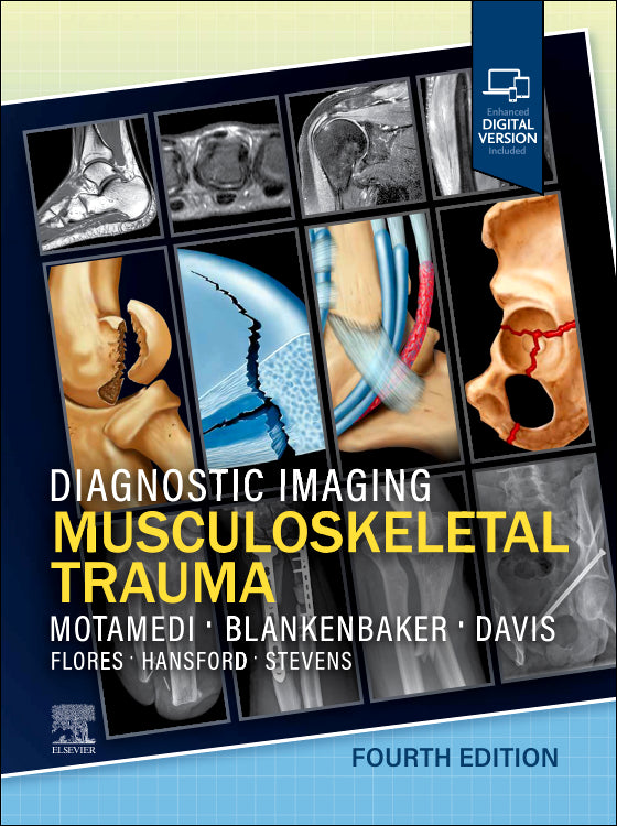 Diagnostic Imaging Musculoskeletal Trauma 4th/2026