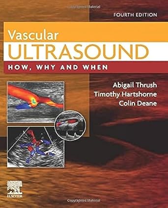 Vascular Ultrasound: How, Why and When - 4E