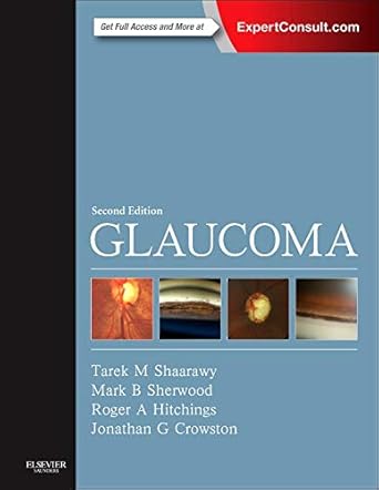 Glaucoma: Expert Consult:2-Vol Set - 2E