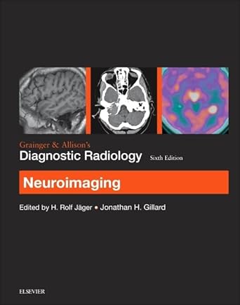 Grainger & Allison’s Diagnostic Radiology: Neuroimaging