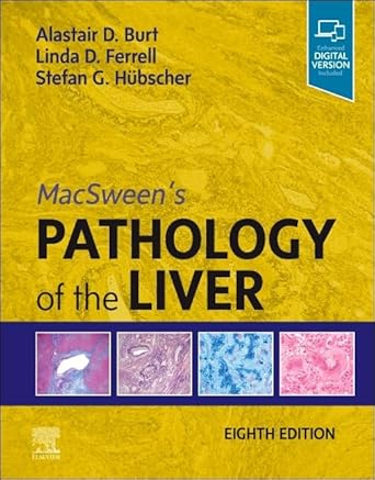 MacSween's Pathology of the Liver-8E