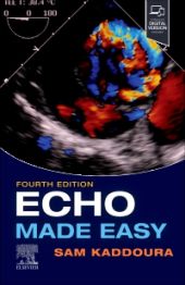 Echo Made Easy, 4th Edition