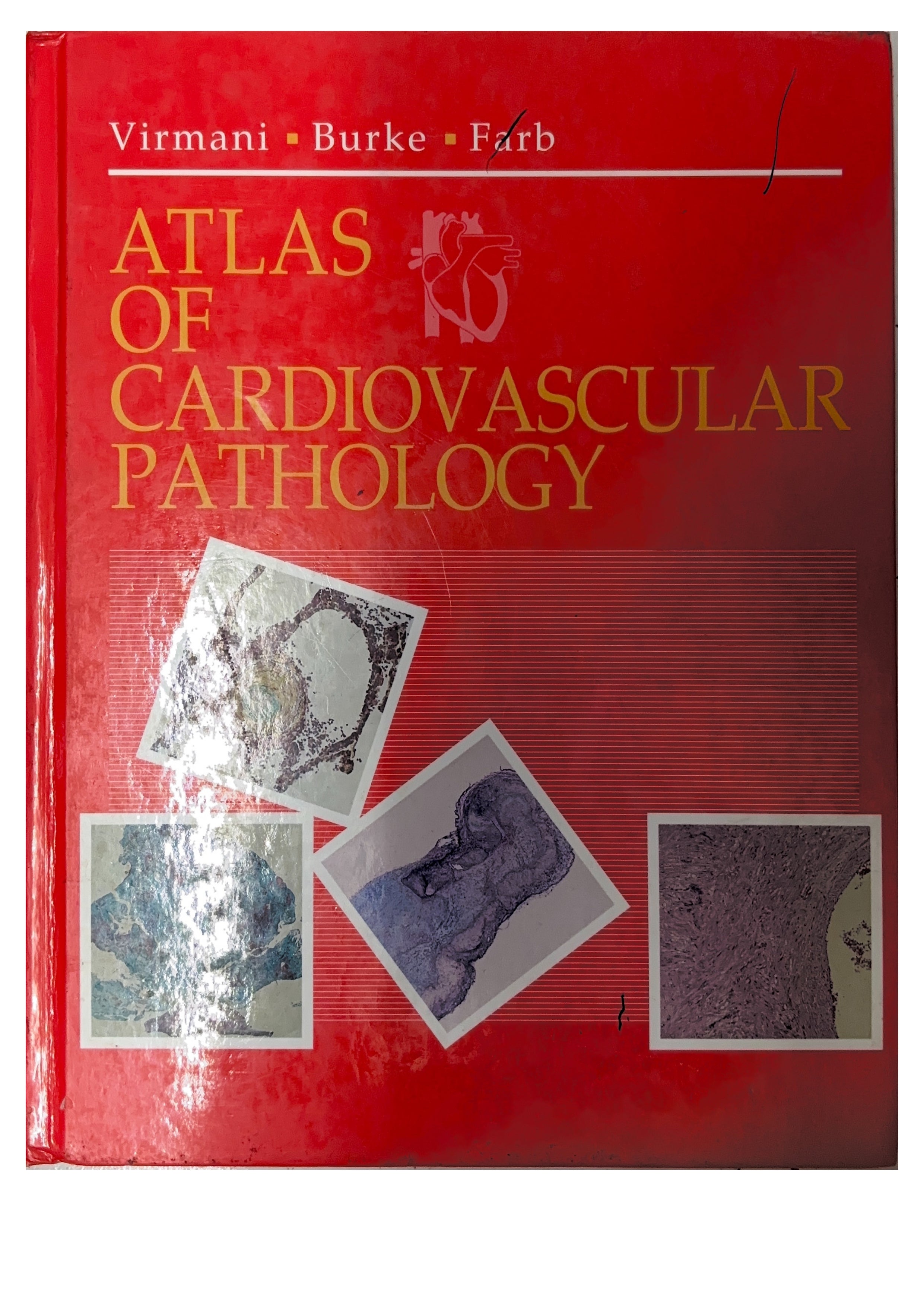 ATLAS OF CARDIOVASCULAR PATHOLOGY