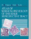 ATLAS OF SURGICAL PATHOLOGY OF THE MALE REPRODUCTI