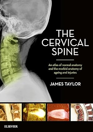 The Cervical Spine: An atlas of normal anatomy and the morbid anatomy of ageing and injuries -1E