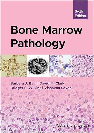 Bone Marrow Pathology