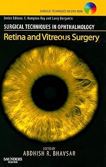 Surgical Techniques in Ophthalmology Series: Retina and Vitreous Surgery: Text with DVD - 1E