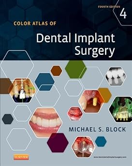 Color Atlas of Dental Implant Surgery - 4E