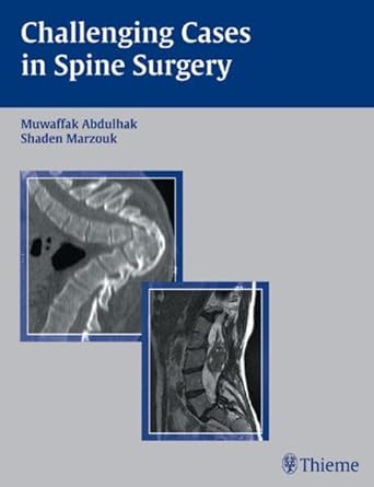 Challenging Cases in Spine Surgery