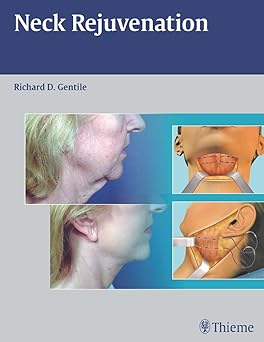 Neck Rejuvenation-Gentile