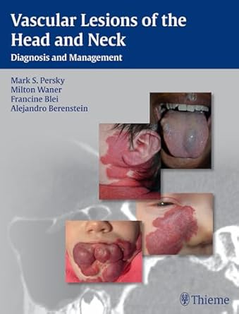 Vascular Lesions of the Head and Neck