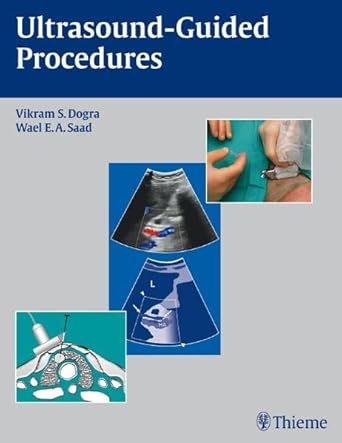 Ultrasound Guided Procedures