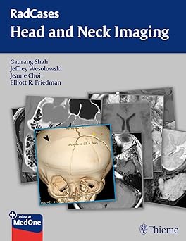 RadCases Head and Neck Imaging 1st Edition