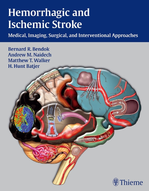 Hemorrhagic and Ischemic Stroke