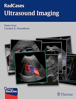 RadCases Ultrasound Imaging