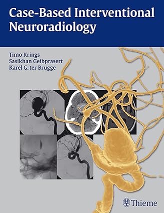 Case- Based Interventional Neuroradiology