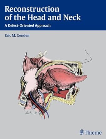 Reconstruction of the Head and Neck
