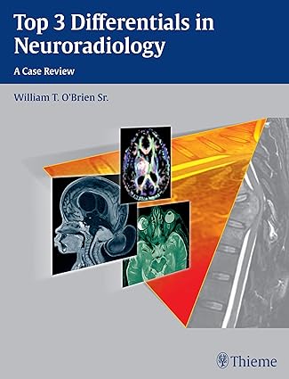 Top 3 Differentials in Neuroradiology 1st Ed.