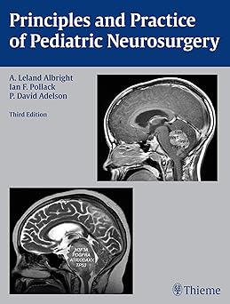 Principles and Practice of Pediatric Neurosurgery 3rd Edition