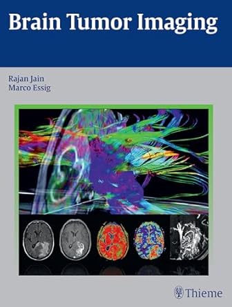 Brain Tumor Imaging 1st Ed.