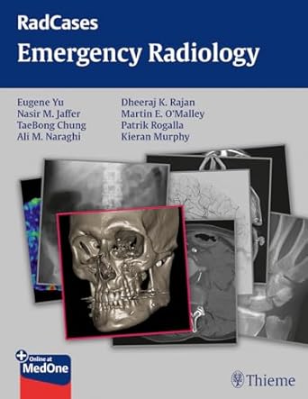 Radcases Emergency Radiology
