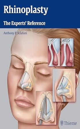 Rhinoplasty The Experts' Reference 1st Ed.