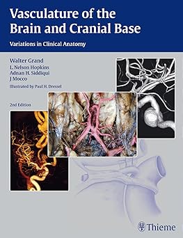 Vasculature of the Brain and Cranial Base 2nd Edition