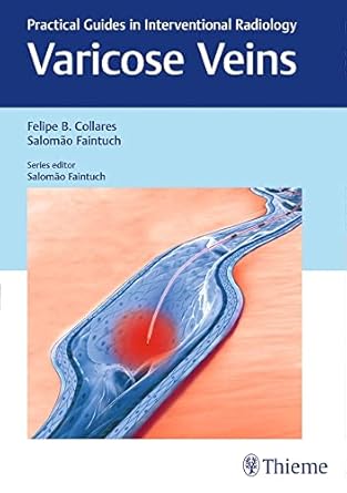 Varicose Veins Practical Guides in Interventional Radiology 1st Edition