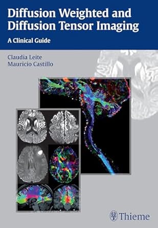 Diffusion Weighted and Diffusion Tensor Imaging A Clinical Guide 1st Edition