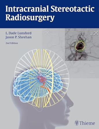 Intracranial Stereotactic Radiosurgery