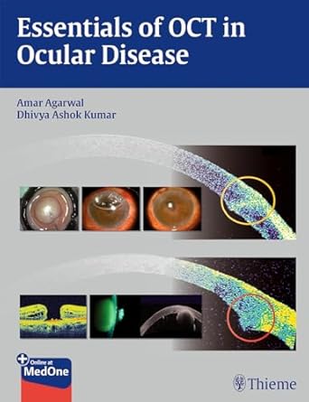 Essentials of OCT in Ocular Disease