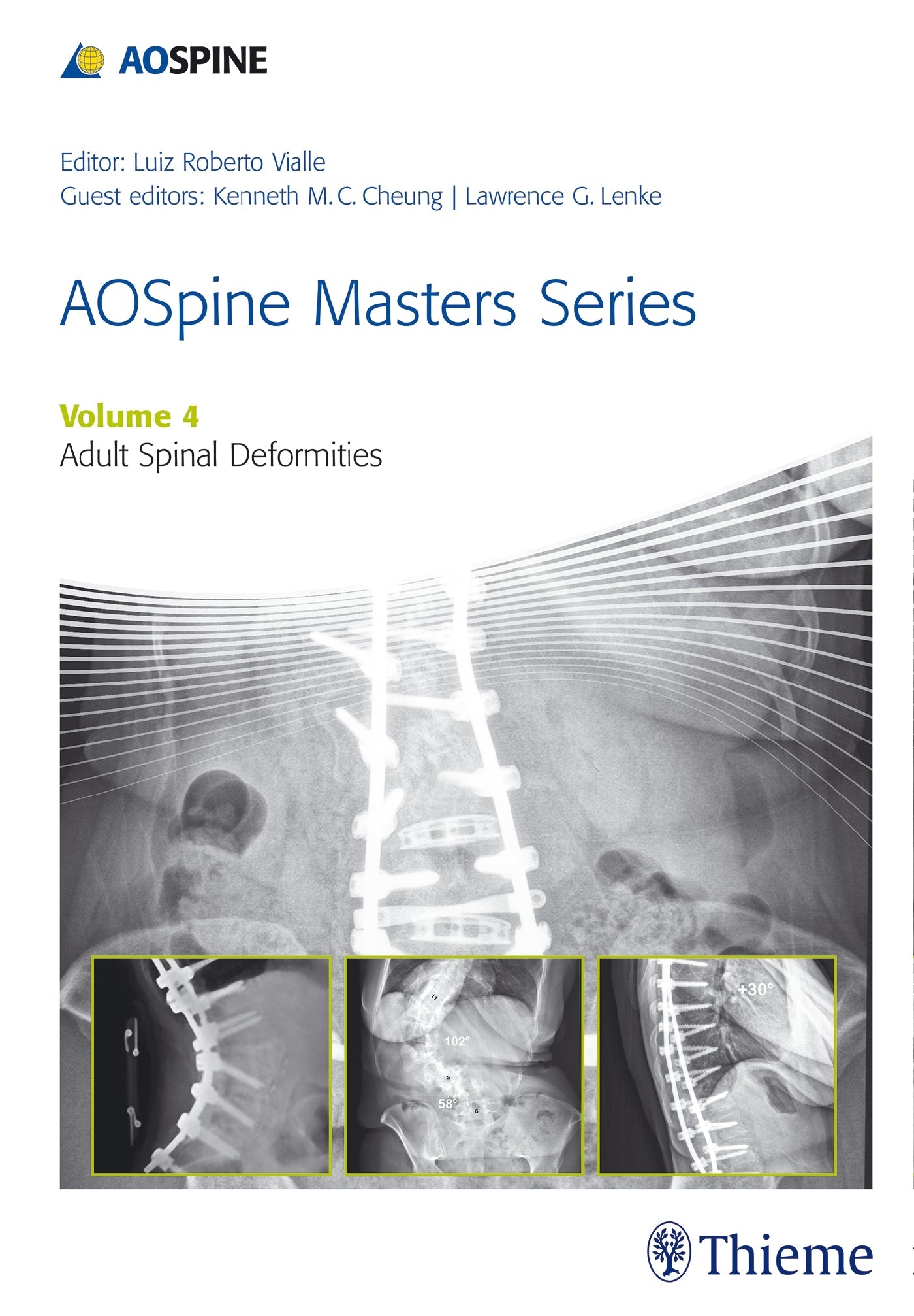 AOSpine Master Series, Vol. 4