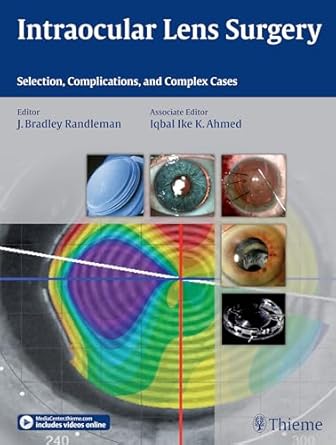 Intraocular Lens Surgery 1st Edition