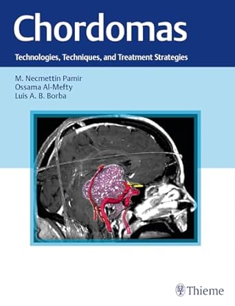 Chordomas