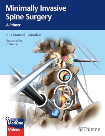 Minimally Invasive Spine Surgery : A Primer 1st Ed.