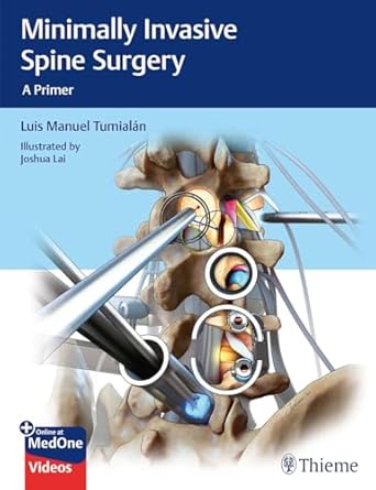 Minimally Invasive Spine Surgery