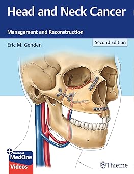 Head and Neck Cancer