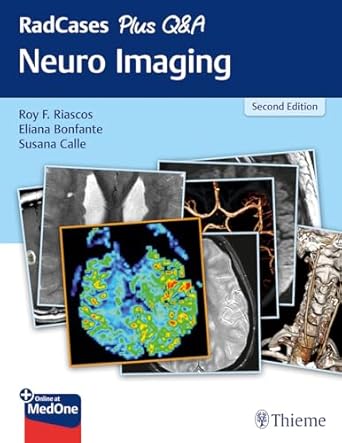 RadCases Plus Q&A Neuro Imaging 2nd Ed.