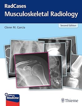 Radcases Musculoskeletal Radiology 2nd Edition