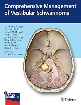 Comprehensive Management of Vestibular Schwannoma 1st Ed.