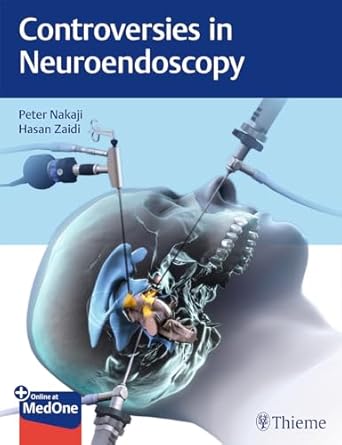 Controversies in Neuroendoscopy 1st Ed.