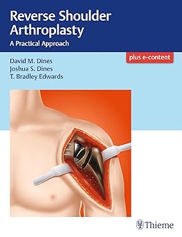 Reverse Shoulder Arthroplasty 1st Edition