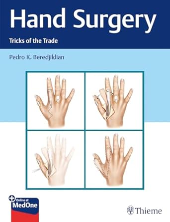 Hand Surgery : Tricks of the Trade 1st Ed.