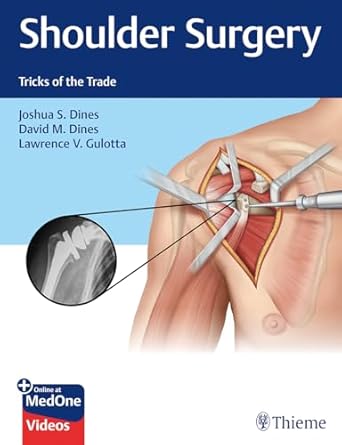 Shoulder Surgery Tricks of the Trade 1st Ed.